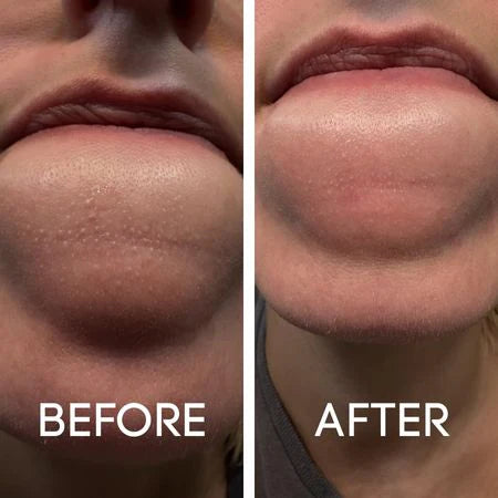 Before and After