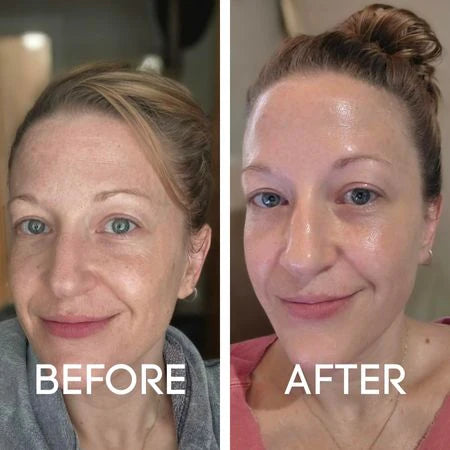 Before and After