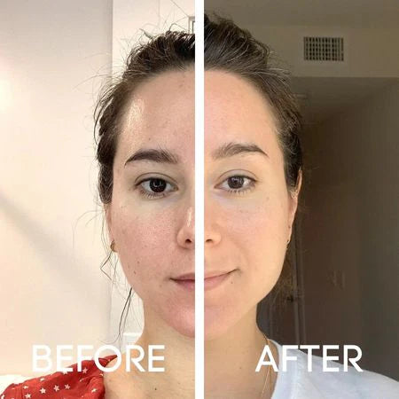 Before and After